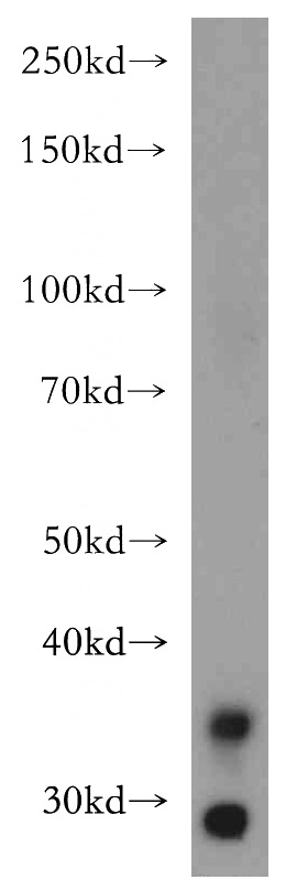 human kidney tissue were subjected to SDS PAGE followed by western blot with Catalog No:112230(LIMS1 antibody) at dilution of 1:400