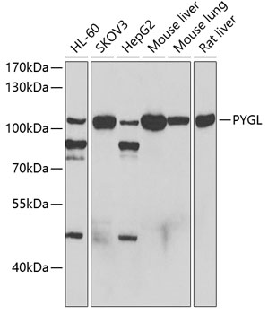 Western blot - PYGL Polyclonal Antibody 