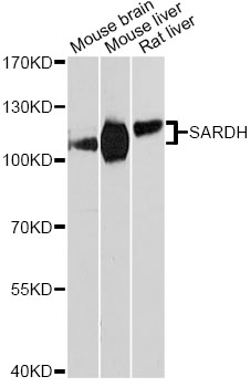 Western blot - SARDH Polyclonal Antibody 