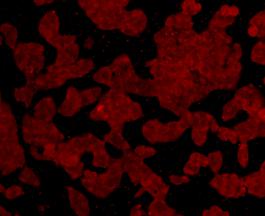 Fig3: ICC staining C19orf35 in Hela cells (red). Cells were fixed in paraformaldehyde, permeabilised with 0.25% Triton X100/PBS.
