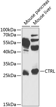 Western blot - CTRL Polyclonal Antibody 