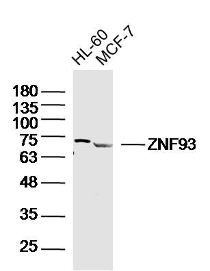 Fig1: Sample:; HL-60 (human)cell Lysate at 40 ug; MCF-7 (human)cell Lysate at 40 ug; Primary: Anti-ZNF93 at 1/300 dilution; Secondary: IRDye800CW Goat Anti-RabbitIgG at 1/20000 dilution; Predicted band size: 71 kD; Observed band size: 71 kD