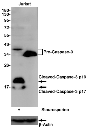 Western blot analysis of extracts from Jurkat cells, untreated (-) or treated with Staurosporine (1 μM; 3 hr), using Caspase-3 Rabbit pAb (166660, upper) or β-Actin (8F10) Mouse mAb (lower).