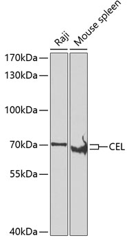 Western blot - CEL Polyclonal Antibody 