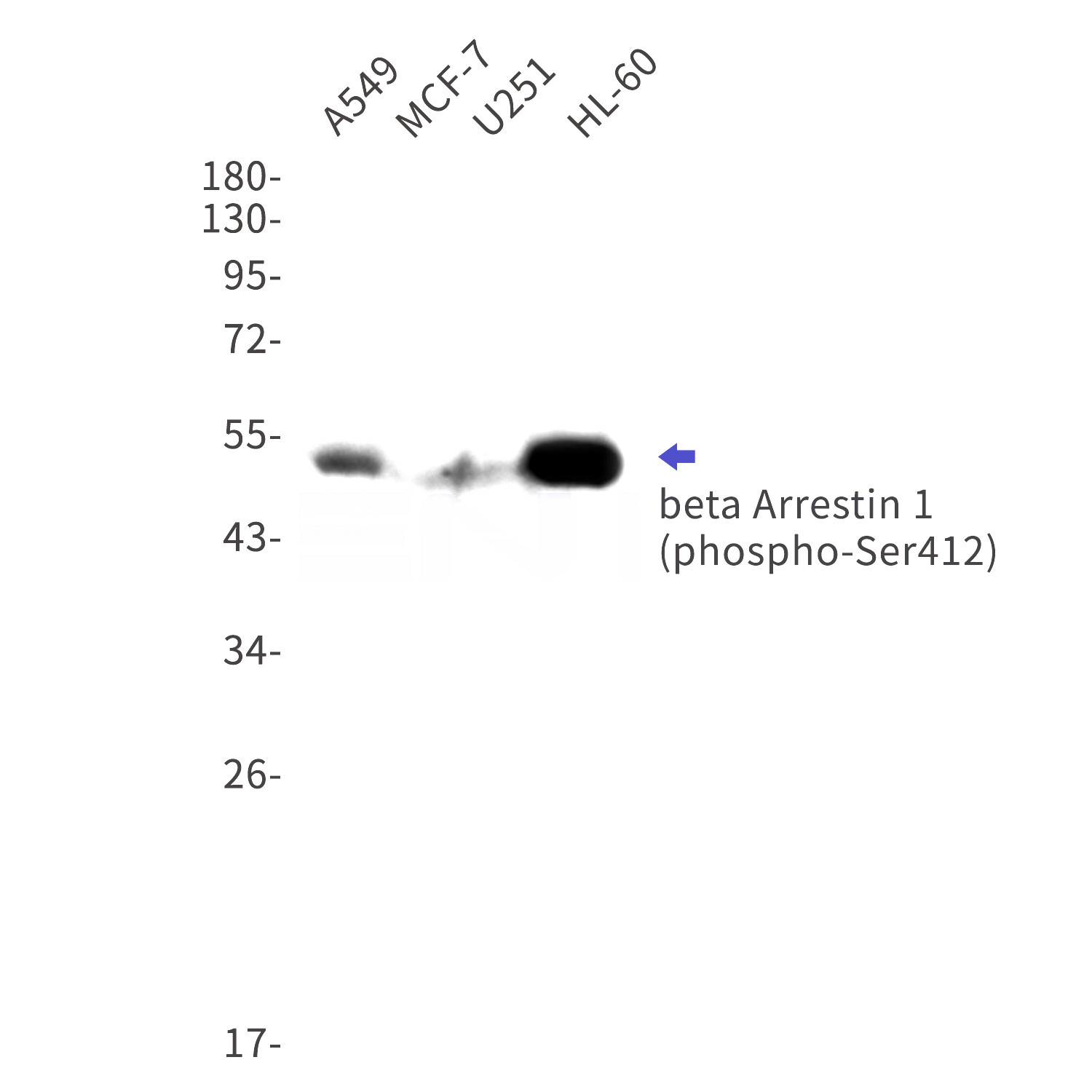 Western blot detection of phospho-beta Arrestin 1 (Ser412) in A549,MCF-7,U251,HL-60 cell lysates using phospho-beta Arrestin 1 (Ser412) Rabbit mAb(1:1000 diluted).Predicted band size:50kDa.Observed band size:50kDa.