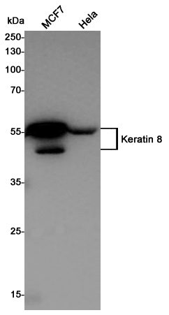 Western blot detection of Keratin 8 in MCF7,Hela cell lysates using Keratin 8 Rabbit pAb(1:1000 diluted).Predicted band size:54KDa.Observed band size:54KDa.