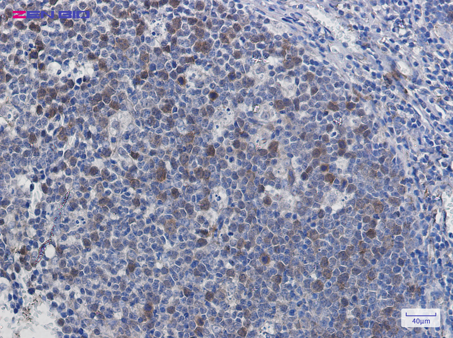 Immunohistochemistry of Securin in paraffin-embedded Human tonsil using Securin Rabbit pAb at dilution 1/20