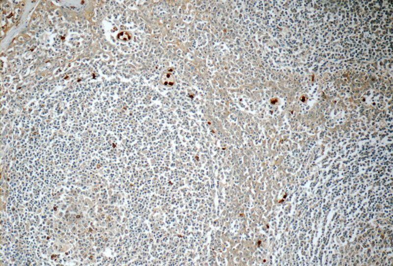 Immunohistochemistry of paraffin-embedded human tonsillitis tissue slide using Catalog No:112400(LY6G5B Antibody) at dilution of 1:50 (under 10x lens)