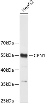 Western blot - CPN1 Polyclonal Antibody 