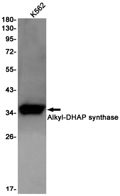 Western blot detection of Alkyl-DHAP synthase in K562 cell lysates using Alkyl-DHAP synthase Rabbit pAb(1:1000 diluted).Predicted band size:73kDa.Observed band size:73kDa.