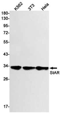 Western blot detection of StAR in K562,3T3,Hela cell lysates using StAR Rabbit mAb(1:1000 diluted).Predicted band size:32kDa.Observed band size:32kDa.