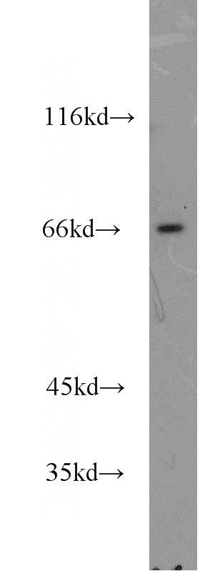 mouse colon tissue were subjected to SDS PAGE followed by western blot with Catalog No:110138(DYNC1LI2 antibody) at dilution of 1:500
