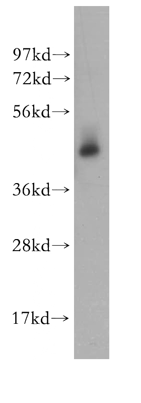 mouse brain tissue were subjected to SDS PAGE followed by western blot with Catalog No:115674(STAMBP antibody) at dilution of 1:300