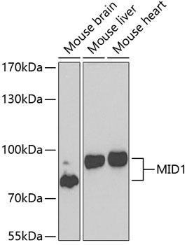 Western blot - MID1 Polyclonal Antibody 