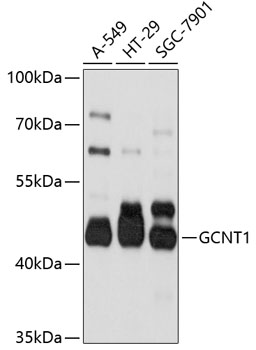 Western blot - GCNT1 Polyclonal Antibody 
