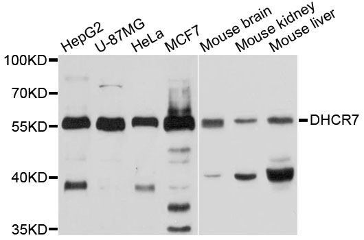 Western blot - DHCR7 Polyclonal Antibody 