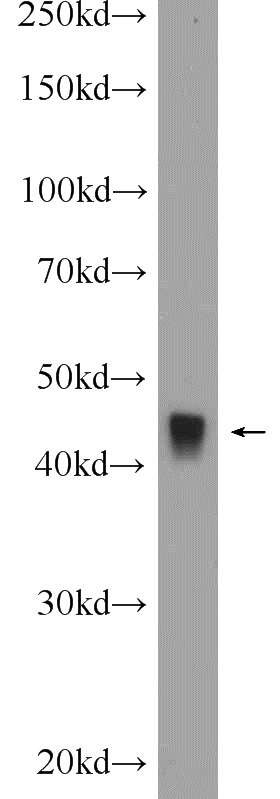 rat skeletal muscle tissue were subjected to SDS PAGE followed by western blot with Catalog No:116164(TOB2 Antibody) at dilution of 1:300