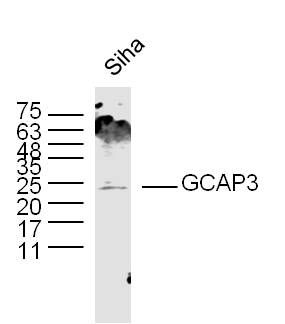 Fig1: Sample:; Siha Cell (Human) Lysate at 30 ug; Primary: Anti- GCAP3 at 1/300 dilution; Secondary: IRDye800CW Goat Anti-Rabbit IgG at 1/20000 dilution; Predicted band size: 24kD; Observed band size: 24kD