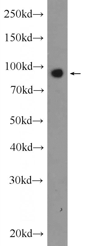 HeLa cells were subjected to SDS PAGE followed by western blot with Catalog No:112010(KIF2A Antibody) at dilution of 1:1200