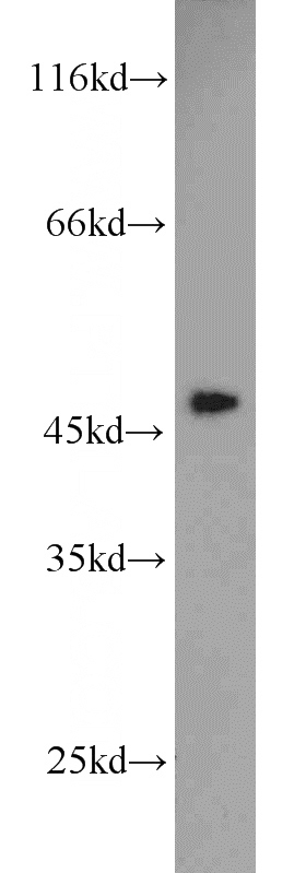 HT-1080 cells were subjected to SDS PAGE followed by western blot with Catalog No:111566(SERPINH1 antibody) at dilution of 1:100