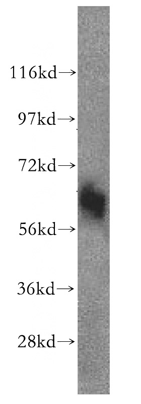 HeLa cells were subjected to SDS PAGE followed by western blot with Catalog No:115377(SLC43A1 antibody) at dilution of 1:0