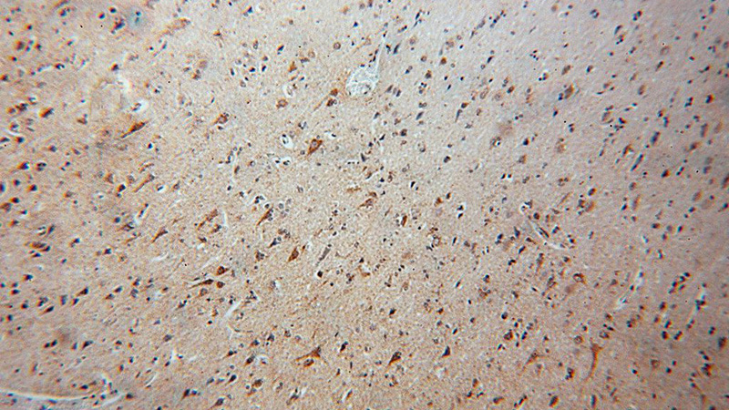 Immunohistochemical of paraffin-embedded human brain using Catalog No:113061(NDUFA5 antibody) at dilution of 1:50 (under 10x lens)