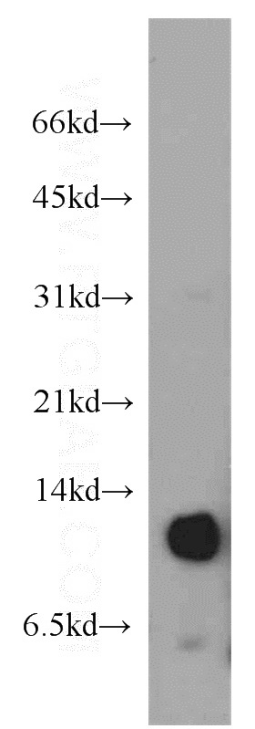 mouse thymus tissue were subjected to SDS PAGE followed by western blot with Catalog No:111408(HIST1H4E antibody) at dilution of 1:500