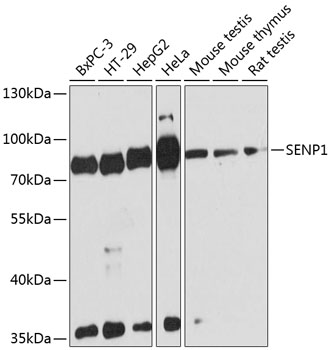 Western blot - SENP1 Polyclonal Antibody 