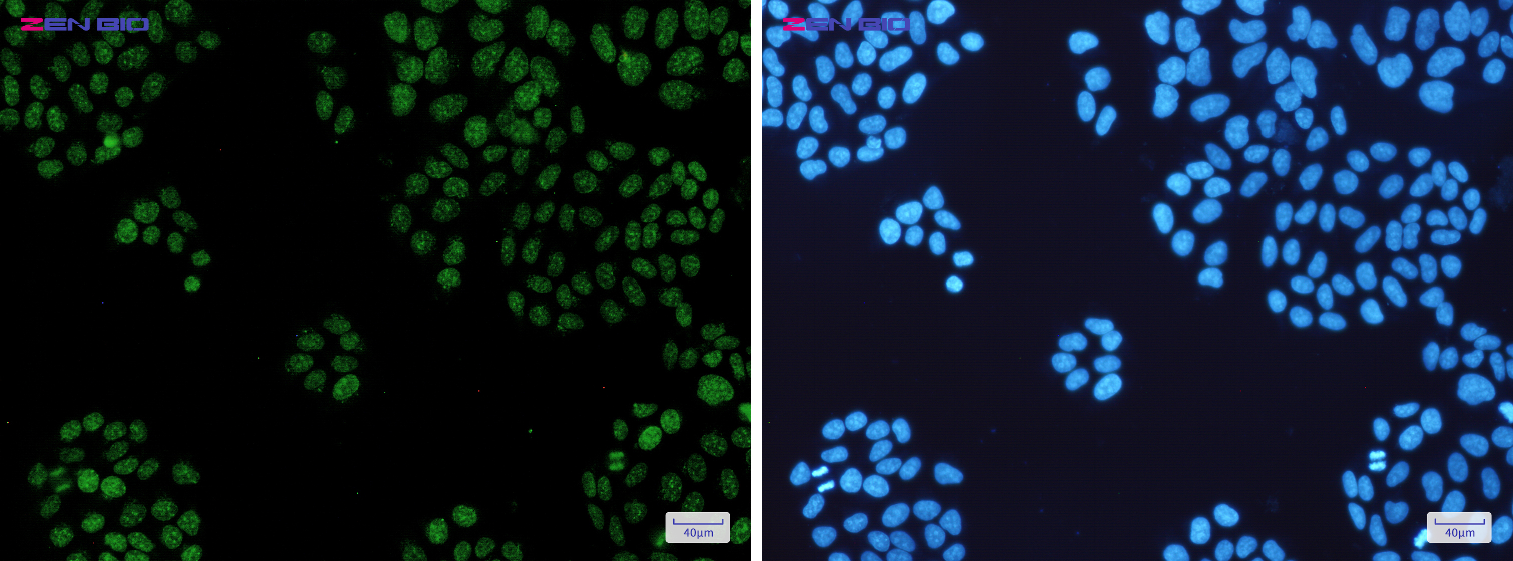 Immunocytochemistry of HP1 alpha(green) in Hela cells using HP1 alpha Rabbit mAb at dilution 1/50, and DAPI(blue)