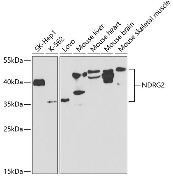 Western blot - NDRG2 Polyclonal Antibody 