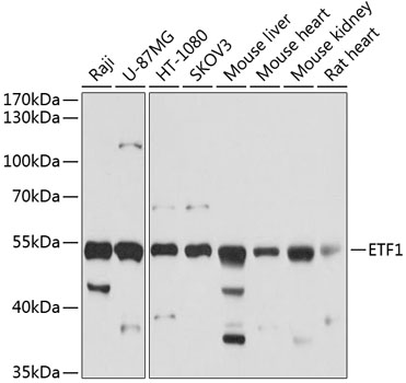 Western blot - ETF1 Polyclonal Antibody 