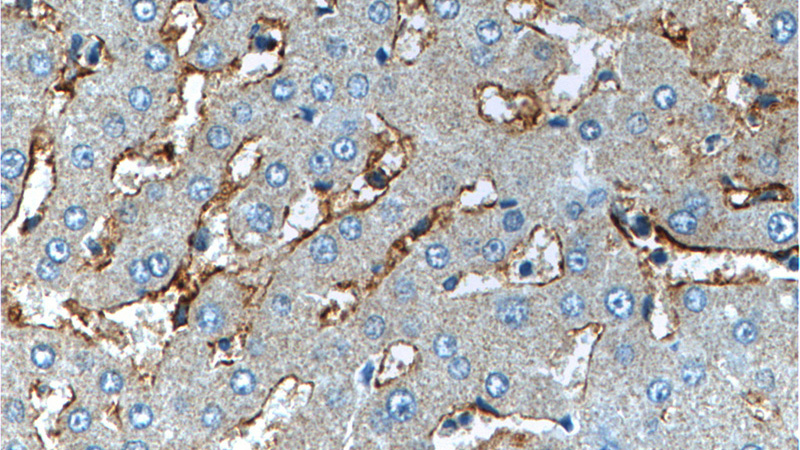 Immunohistochemistry of paraffin-embedded human liver tissue slide using Catalog No:109053(CD14 Antibody) at dilution of 1:200 (under 40x lens).