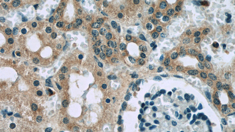 Immunohistochemistry of paraffin-embedded human kidney slide using Catalog No:114974(SASS6 Antibody) at dilution of 1:50
