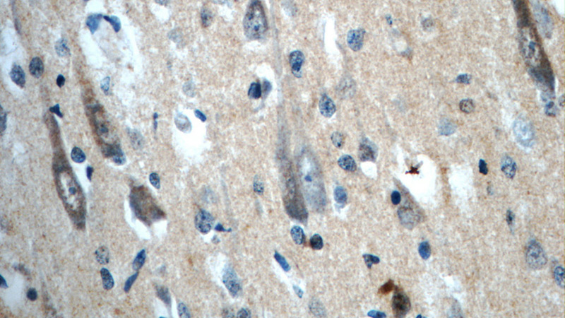Immunohistochemistry of paraffin-embedded human brain slide using Catalog No:113222(NPS Antibody) at dilution of 1:50 (under 40x lens)