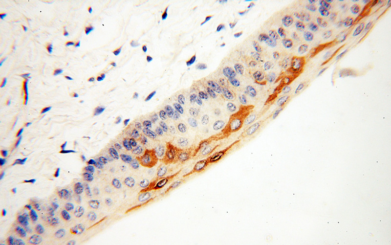 Immunohistochemical of paraffin-embedded human eye using Catalog No:116491(TULP1 antibody) at dilution of 1:50 (under 40x lens)