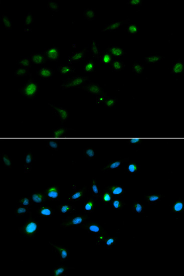 Immunofluorescence - TRIM63 Polyclonal Antibody. Immunofluorescence analysis of A549 cells using TRIM63 antibody . Blue: DAPI for nuclear staining.