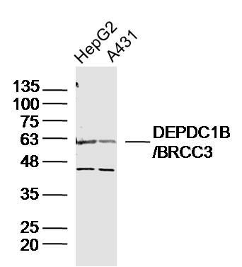 Fig1: Sample:; HepG2 Cell (Human) Lysate at 30 ug; A431 Cell (Human) Lysate at 30 ug; Primary: Anti-DEPDC1B/BRCC3 at 1/300 dilution; Secondary: IRDye800CW Goat Anti-Rabbit IgG at 1/20000 dilution; Predicted band size: 62kD; Observed band size: 62kD
