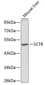 Western blot - SCTR Polyclonal Antibody 