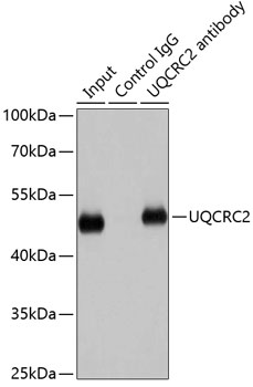 Immunohistochemistry - UQCRC2 Polyclonal Antibody 