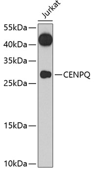 Western blot - CENPQ Polyclonal Antibody 