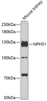 Western blot - NPHS1 Polyclonal Antibody 