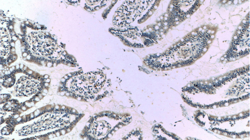 Immunohistochemistry of paraffin-embedded human small intestine tissue slide using Catalog No:112068(KCNJ13 Antibody) at dilution of 1:50 (under 10x lens)