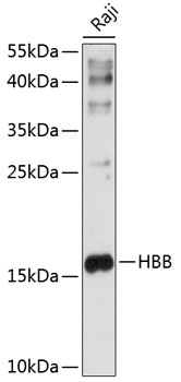 Western blot - HBB Polyclonal Antibody 