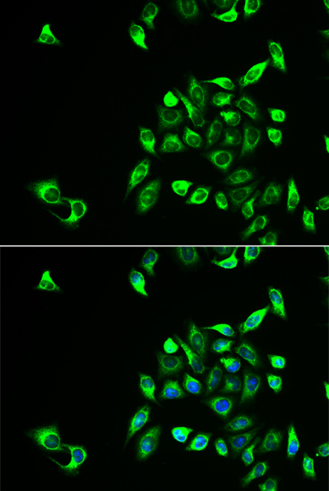 Immunofluorescence - CSNK1A1L Polyclonal Antibody 