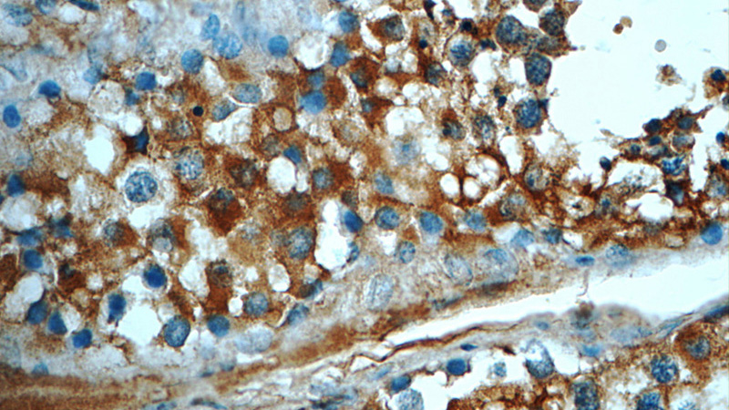 Immunohistochemistry of paraffin-embedded human testis tissue slide using Catalog No:108304(ATP6V1A Antibody) at dilution of 1:50 (under 40x lens)