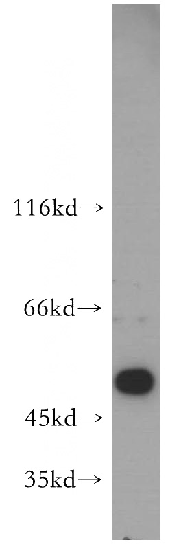 human liver tissue were subjected to SDS PAGE followed by western blot with Catalog No:113891(PIGB antibody) at dilution of 1:800