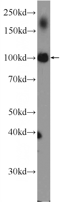 mouse liver tissue were subjected to SDS PAGE followed by western blot with Catalog No:114085(PPARGC1B Antibody) at dilution of 1:300