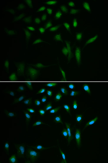 Immunofluorescence - SUMO3 Polyclonal Antibody 