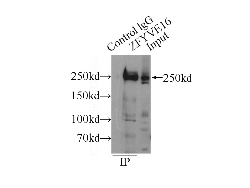 IP Result of anti-ZFYVE16 (IP:Catalog No:117045, 5ug; Detection:Catalog No:117045 1:500) with HeLa cells lysate 2000ug.