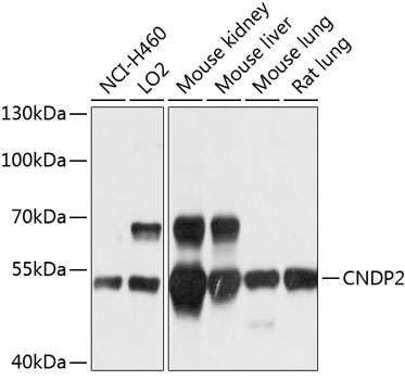Western blot - CNDP2 Polyclonal Antibody 